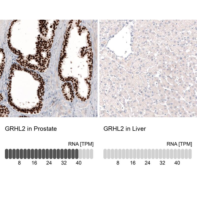 GRHL2 Antibody (CL3760) - Azide and BSA Free Immunohistochemistry-Paraffin: GRHL2 Antibody [NBP3-44000]
