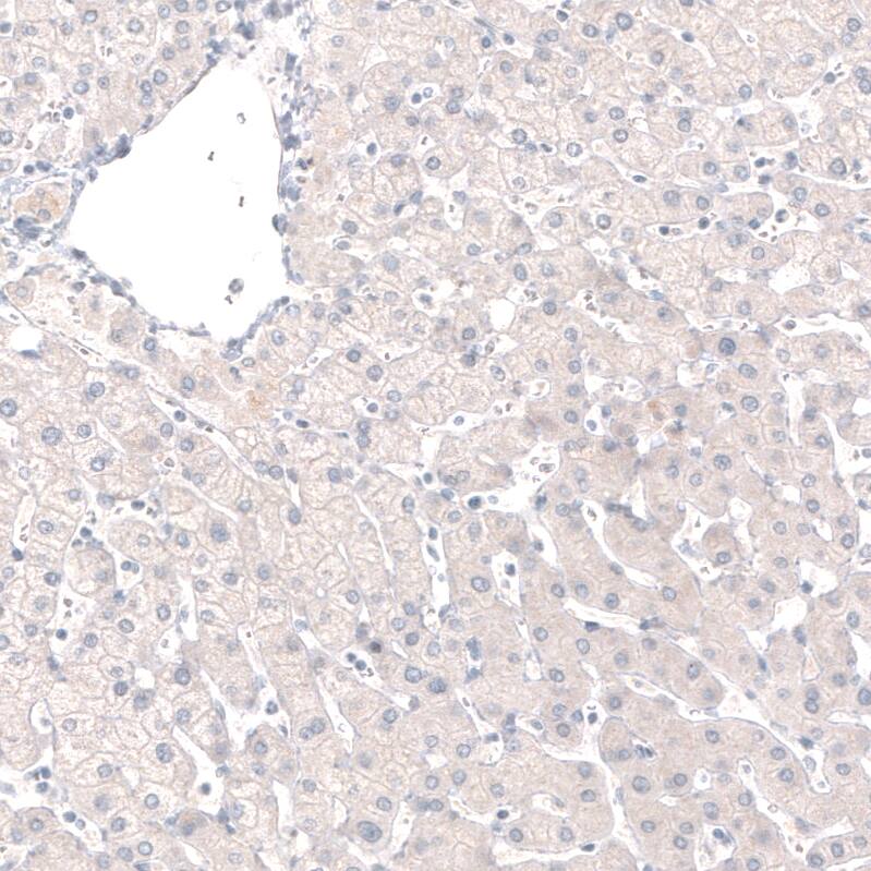 GRHL2 Antibody (CL3760) - Azide and BSA Free Immunohistochemistry-Paraffin: GRHL2 Antibody [NBP3-44000]