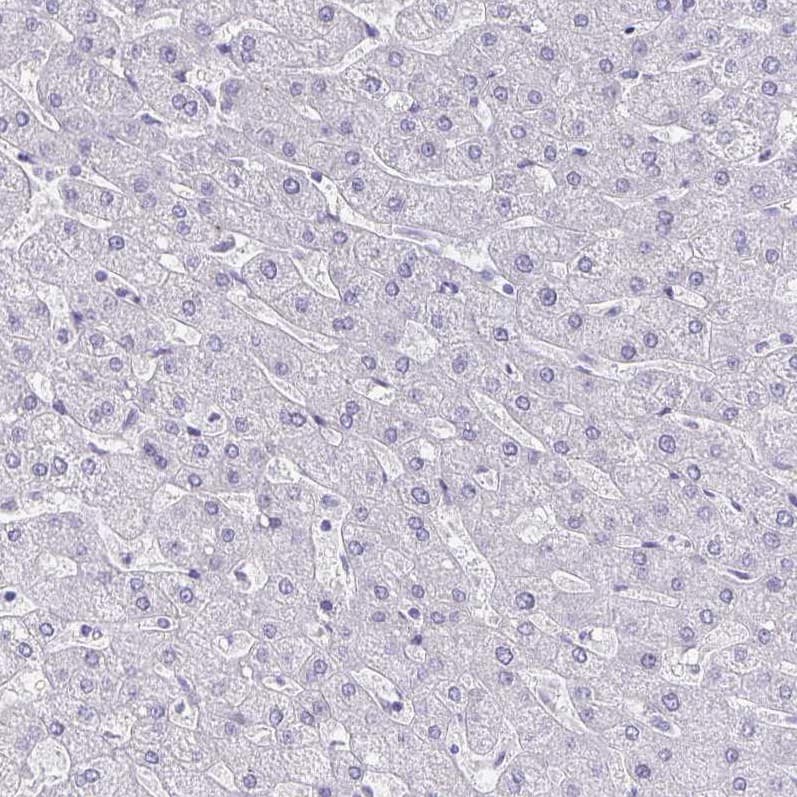Chromogranin A Antibody (CL0166) - Azide and BSA Free Immunohistochemistry-Paraffin: Chromogranin A Antibody [NBP3-44001]