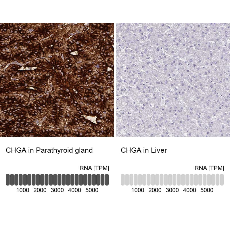 Chromogranin A Antibody (CL0166) - Azide and BSA Free Immunohistochemistry-Paraffin: Chromogranin A Antibody [NBP3-44001]