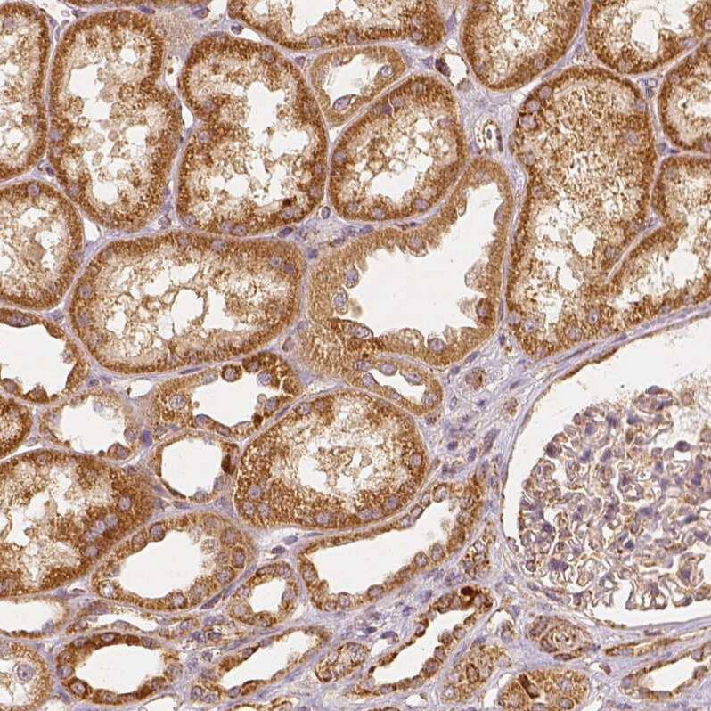 PGAM5 Antibody (CL0624) - Azide and BSA Free Immunohistochemistry-Paraffin: PGAM5 Antibody [NBP3-44002]