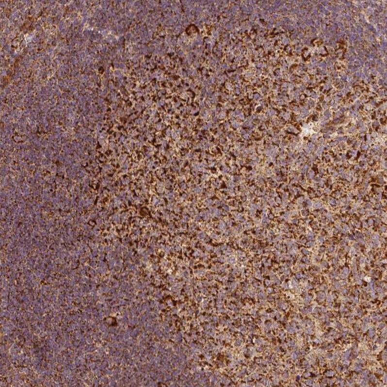 PGAM5 Antibody (CL0624) - Azide and BSA Free Immunohistochemistry-Paraffin: PGAM5 Antibody [NBP3-44002]