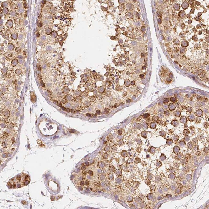 PGAM5 Antibody (CL0624) - Azide and BSA Free Immunohistochemistry-Paraffin: PGAM5 Antibody [NBP3-44002]