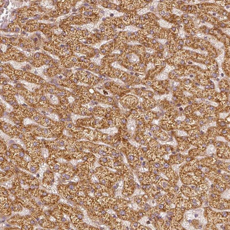 PGAM5 Antibody (CL0624) - Azide and BSA Free Immunohistochemistry-Paraffin: PGAM5 Antibody [NBP3-44002]