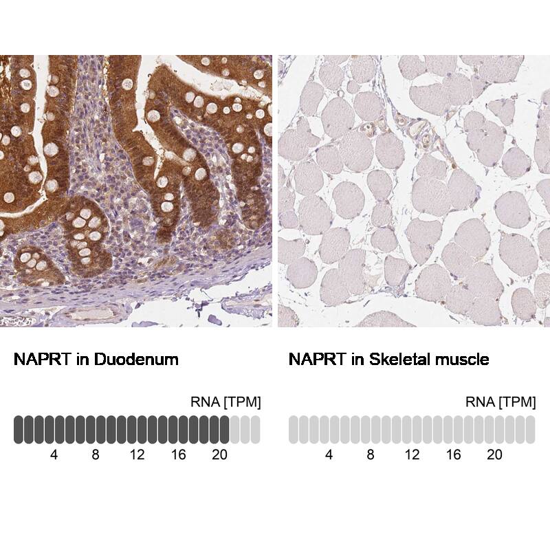 NAPRT1 Antibody (CL0665) - Azide and BSA Free Immunohistochemistry-Paraffin: NAPRT1 Antibody [NBP3-44003]