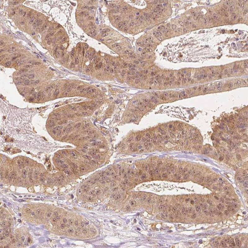 NAPRT1 Antibody (CL0665) - Azide and BSA Free Immunohistochemistry-Paraffin: NAPRT1 Antibody [NBP3-44003]