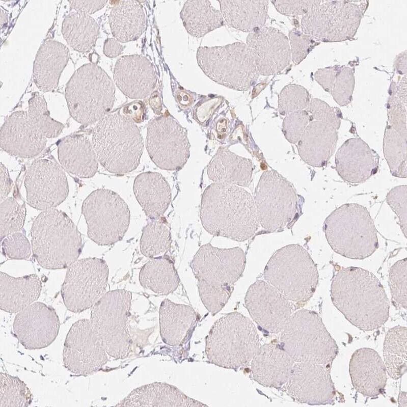 NAPRT1 Antibody (CL0665) - Azide and BSA Free Immunohistochemistry-Paraffin: NAPRT1 Antibody [NBP3-44003]