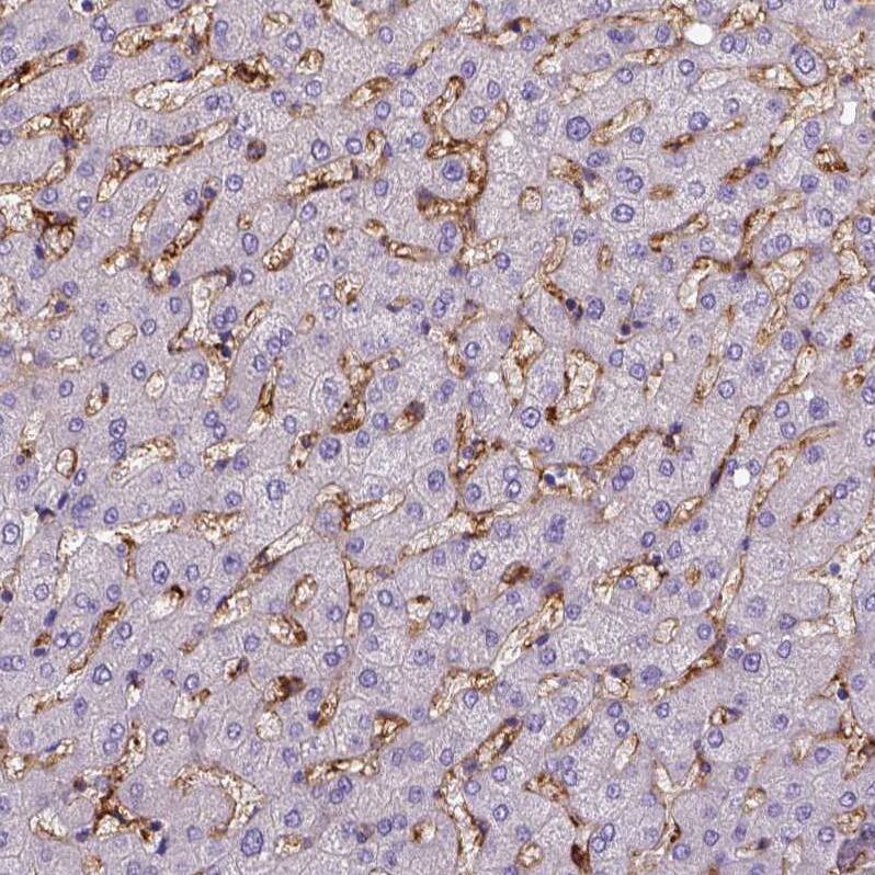 CD14 Antibody (CL1638) - Azide and BSA Free Immunohistochemistry-Paraffin: CD14 Antibody [NBP3-44006]