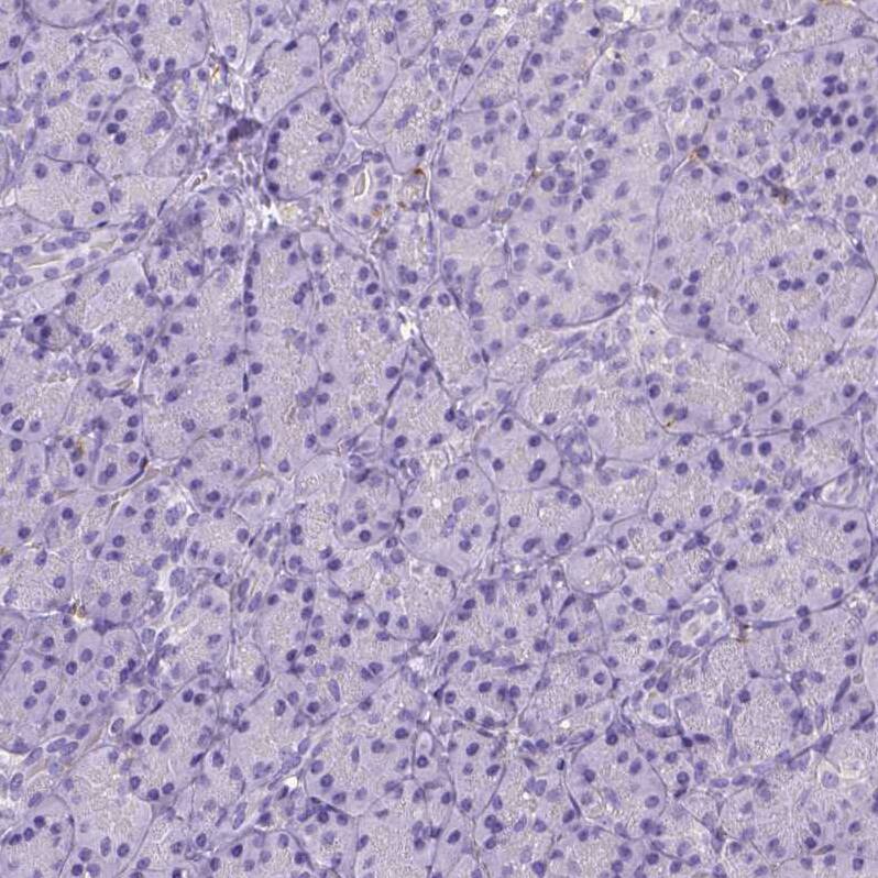 CD14 Antibody (CL1638) - Azide and BSA Free Immunohistochemistry-Paraffin: CD14 Antibody [NBP3-44006]