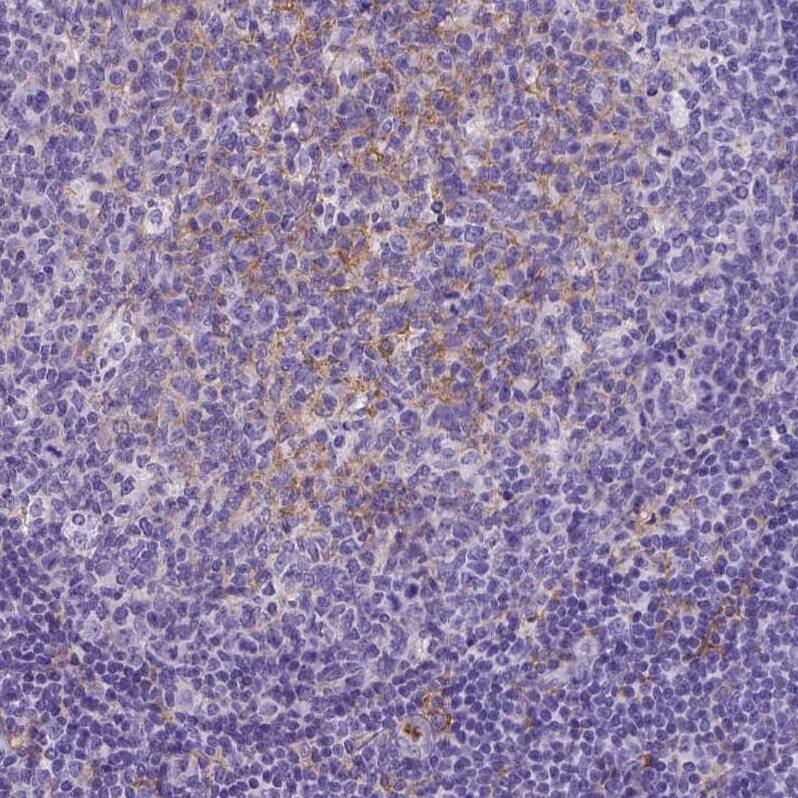 CD14 Antibody (CL1638) - Azide and BSA Free Immunohistochemistry-Paraffin: CD14 Antibody [NBP3-44006]