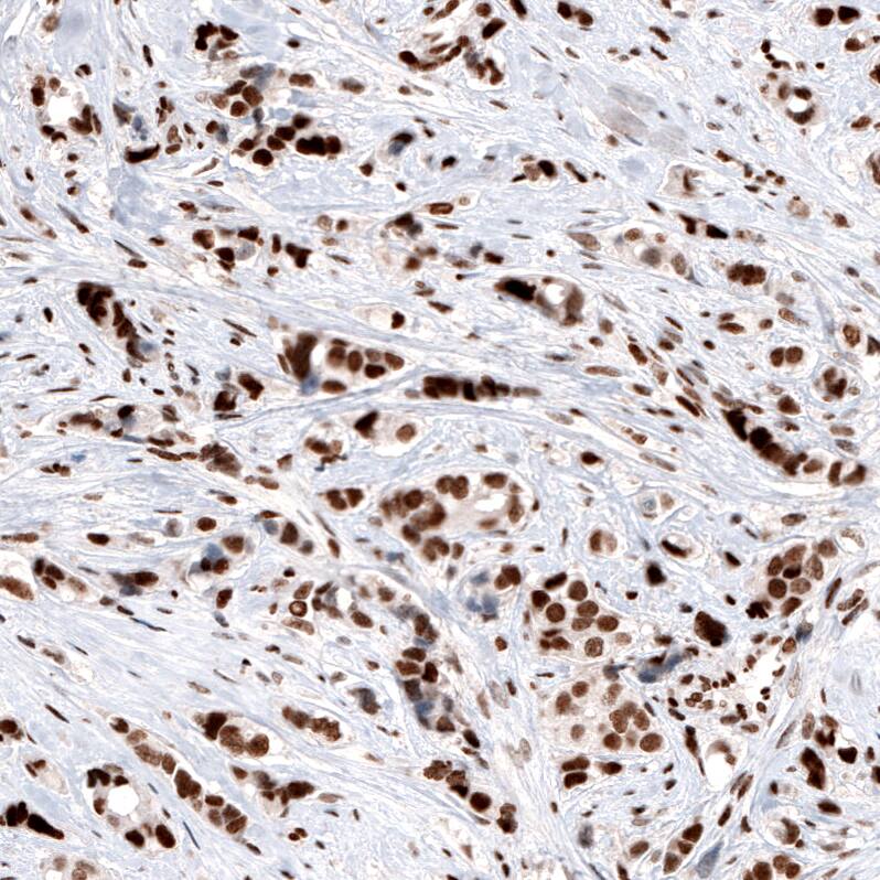 ARID1A Antibody (CL3595) - Azide and BSA Free Immunohistochemistry-Paraffin: ARID1A Antibody [NBP3-44007]