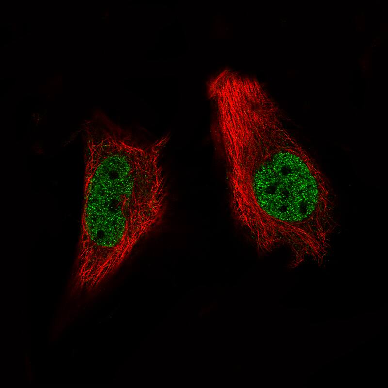 ARID1A Antibody (CL3595) - Azide and BSA Free Immunocytochemistry/ Immunofluorescence: ARID1A Antibody [NBP3-44007]