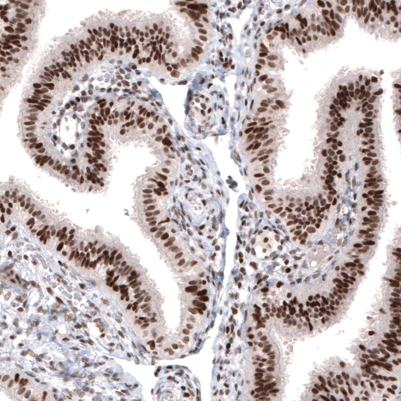 ARID1A Antibody (CL3595) - Azide and BSA Free Immunohistochemistry-Paraffin: ARID1A Antibody [NBP3-44007]