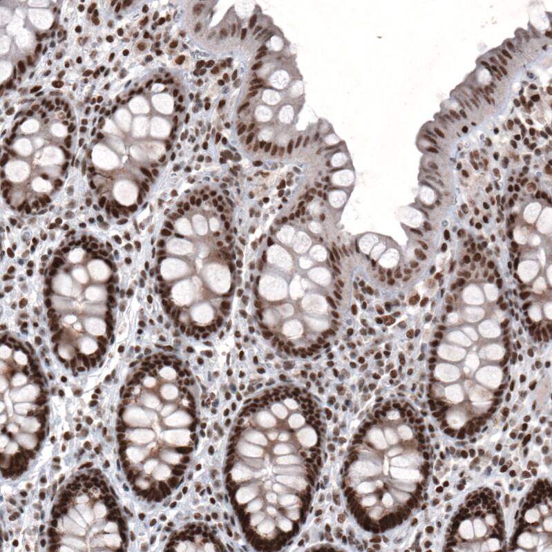 ARID1A Antibody (CL3595) - Azide and BSA Free Immunohistochemistry-Paraffin: ARID1A Antibody [NBP3-44007]