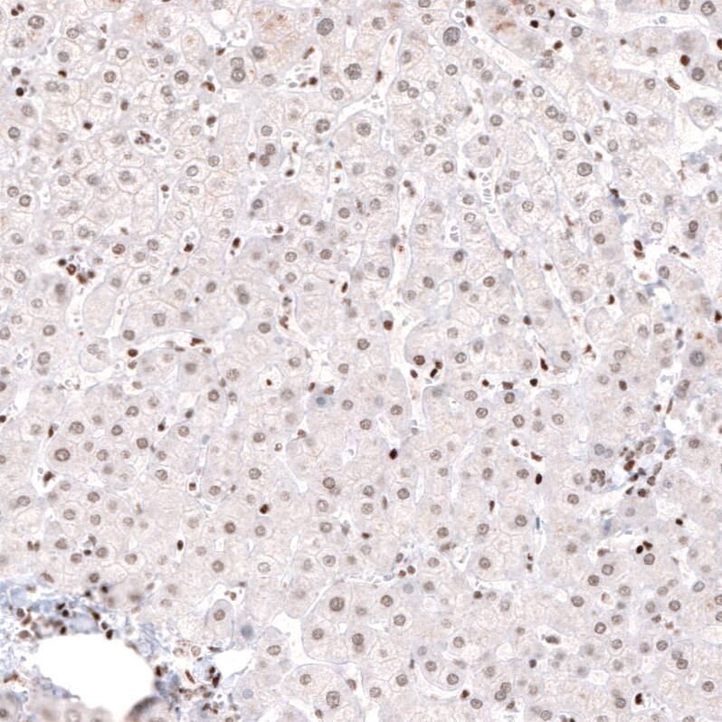 ARID1A Antibody (CL3595) - Azide and BSA Free Immunohistochemistry-Paraffin: ARID1A Antibody [NBP3-44007]