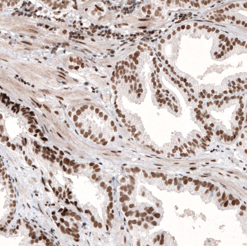 ARID1A Antibody (CL3595) - Azide and BSA Free Immunohistochemistry-Paraffin: ARID1A Antibody [NBP3-44007]