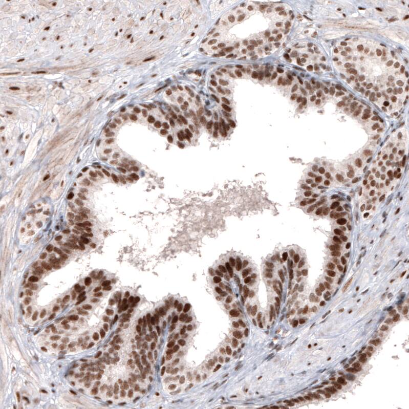 ARID1A Antibody (CL3595) - Azide and BSA Free Immunohistochemistry-Paraffin: ARID1A Antibody [NBP3-44007]