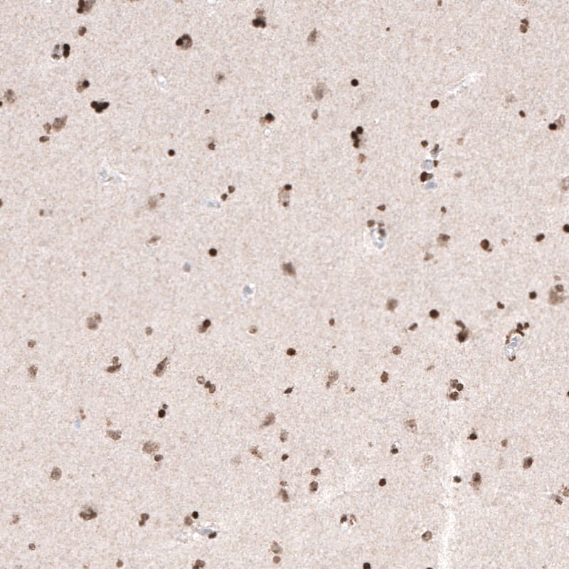 HIST1H3A Antibody (CL4968) - Azide and BSA Free Immunohistochemistry-Paraffin: HIST1H3A Antibody [NBP3-44008]
