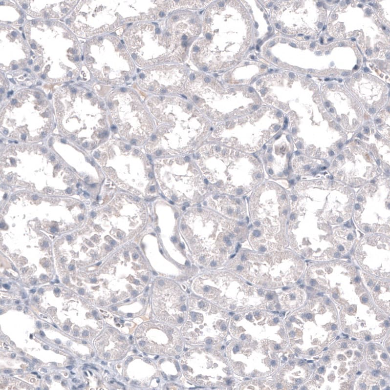 INSM1 Antibody (CL11630) - Azide and BSA Free Immunohistochemistry-Paraffin: INSM1 Antibody [NBP3-44009]