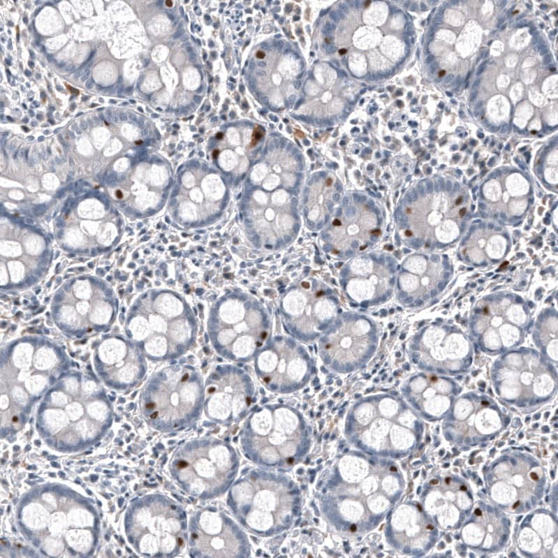 INSM1 Antibody (CL11630) - Azide and BSA Free Immunohistochemistry-Paraffin: INSM1 Antibody [NBP3-44009]