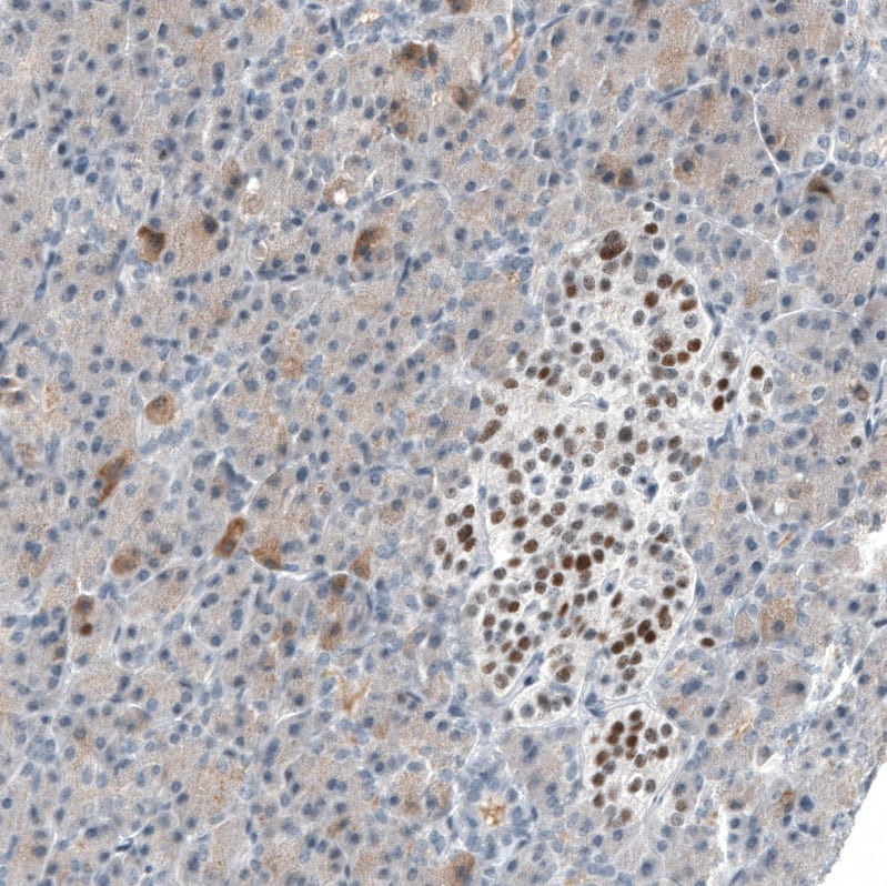 INSM1 Antibody (CL11630) - Azide and BSA Free Immunohistochemistry-Paraffin: INSM1 Antibody [NBP3-44009]