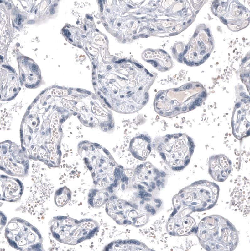 INSM1 Antibody (CL11630) - Azide and BSA Free Immunohistochemistry-Paraffin: INSM1 Antibody [NBP3-44009]