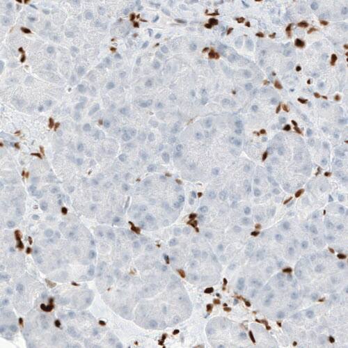 MEF2C Antibody (CL0369) - Azide and BSA Free Immunohistochemistry-Paraffin: MEF2C Antibody [NBP3-44010]