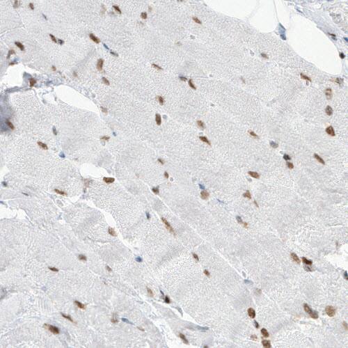 MEF2C Antibody (CL0369) - Azide and BSA Free Immunohistochemistry-Paraffin: MEF2C Antibody [NBP3-44010]
