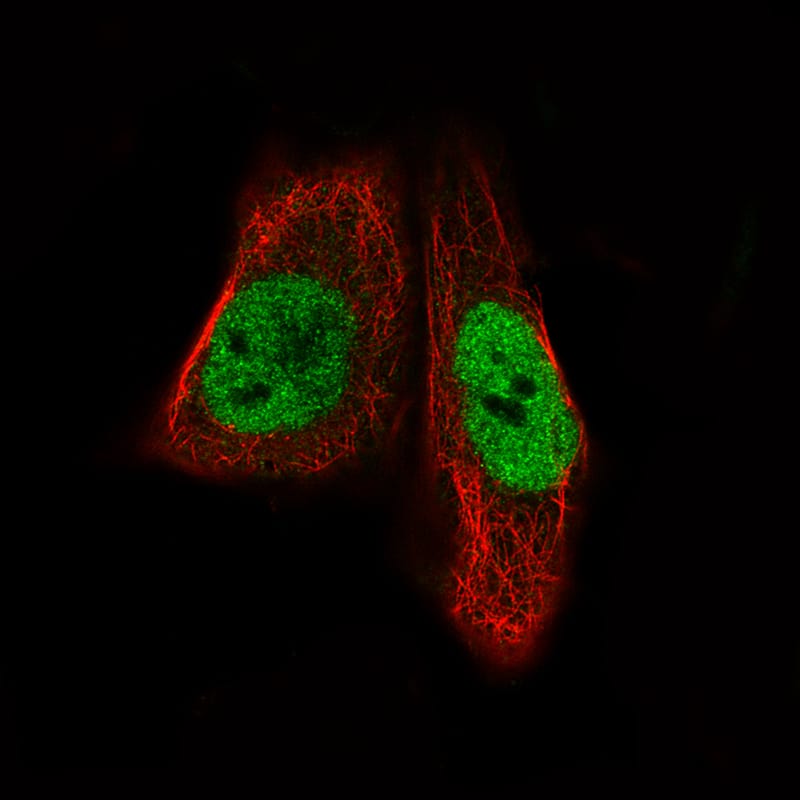 MEF2C Antibody (CL0368) - Azide and BSA Free Immunocytochemistry/ Immunofluorescence: MEF2C Antibody [NBP3-44011]