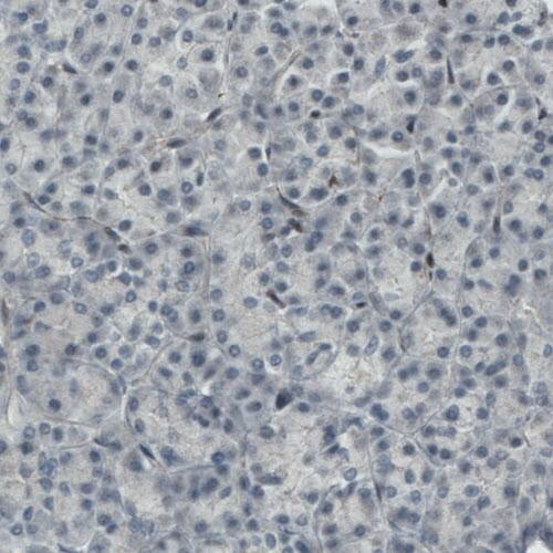 MEF2C Antibody (CL0368) - Azide and BSA Free Immunohistochemistry-Paraffin: MEF2C Antibody [NBP3-44011]