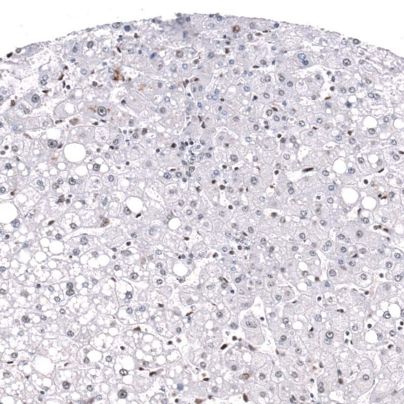 GLI-1 Antibody (CL12193) - Azide and BSA Free Immunohistochemistry-Paraffin: GLI-1 Antibody [NBP3-44013]