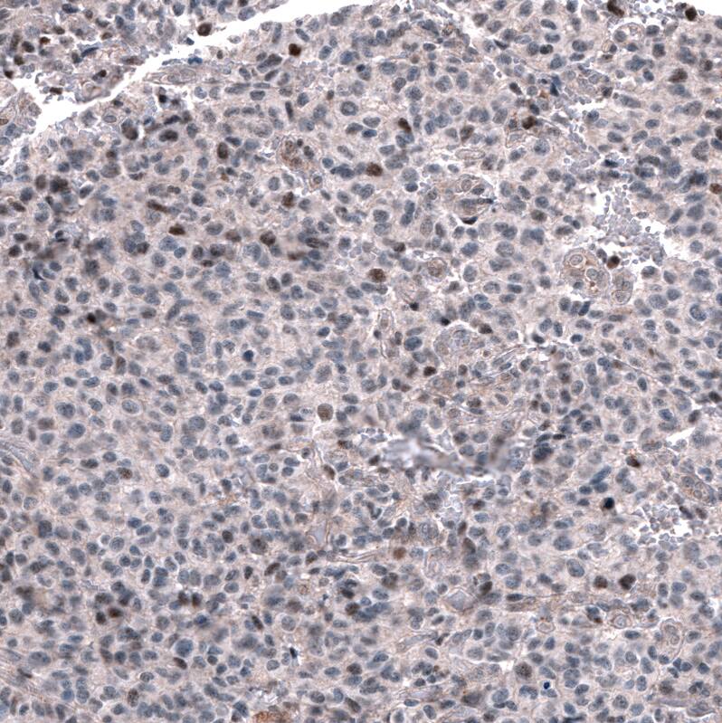GLI-1 Antibody (CL12193) - Azide and BSA Free Immunohistochemistry-Paraffin: GLI-1 Antibody [NBP3-44013]
