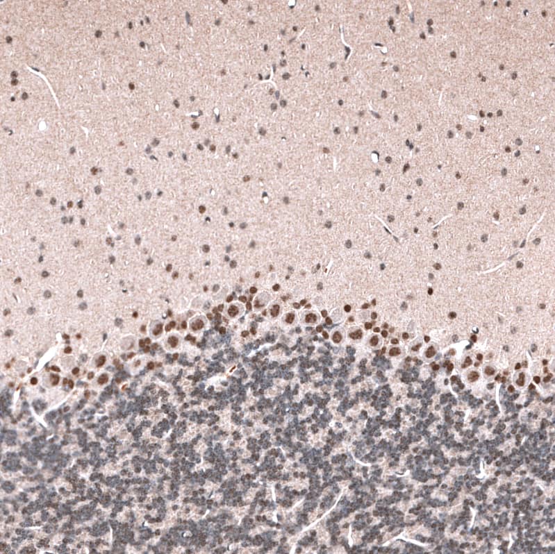 GLI-1 Antibody (CL12193) - Azide and BSA Free Immunohistochemistry-Paraffin: GLI-1 Antibody [NBP3-44013]