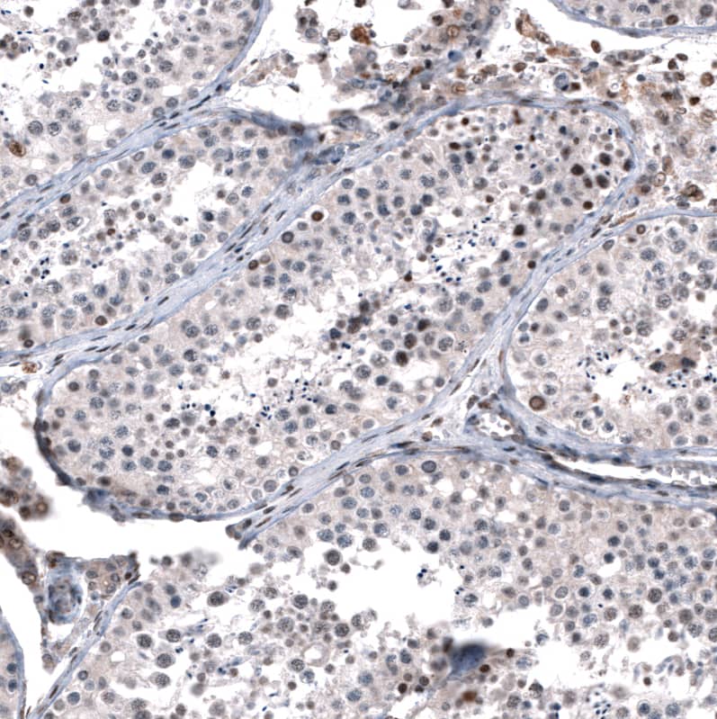 GLI-1 Antibody (CL12193) - Azide and BSA Free Immunohistochemistry-Paraffin: GLI-1 Antibody [NBP3-44013]