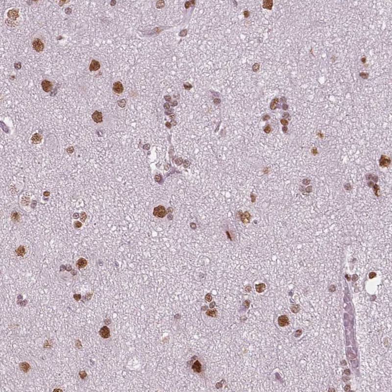 BRD4 Antibody (CL1118) - Azide and BSA Free Immunohistochemistry-Paraffin: BRD4 Antibody [NBP3-44014]