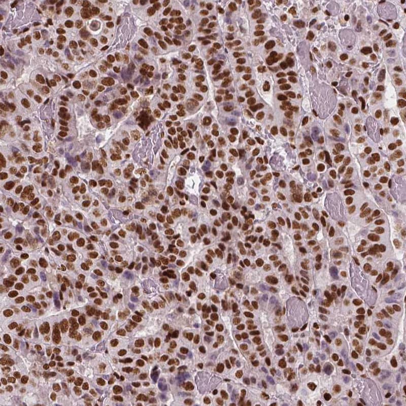 BRD4 Antibody (CL1118) - Azide and BSA Free Immunohistochemistry-Paraffin: BRD4 Antibody [NBP3-44014]
