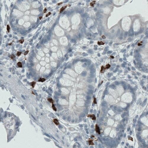 MMP-9 Antibody (CL0539) - Azide and BSA Free Immunohistochemistry-Paraffin: MMP-9 Antibody [NBP3-44016]