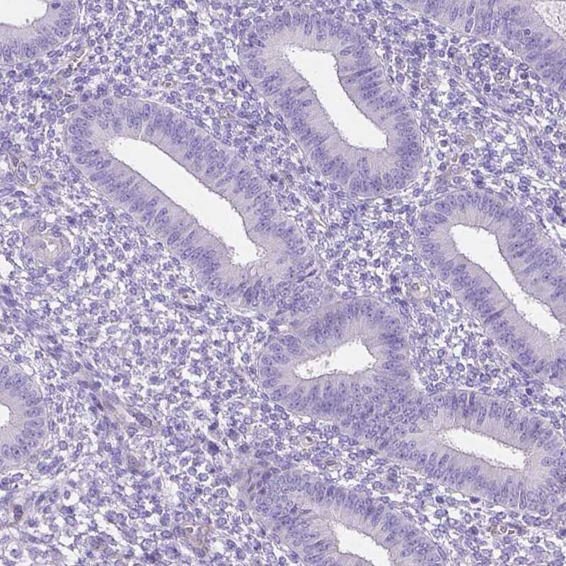 MMP-9 Antibody (CL0539) - Azide and BSA Free Immunohistochemistry-Paraffin: MMP-9 Antibody [NBP3-44016]