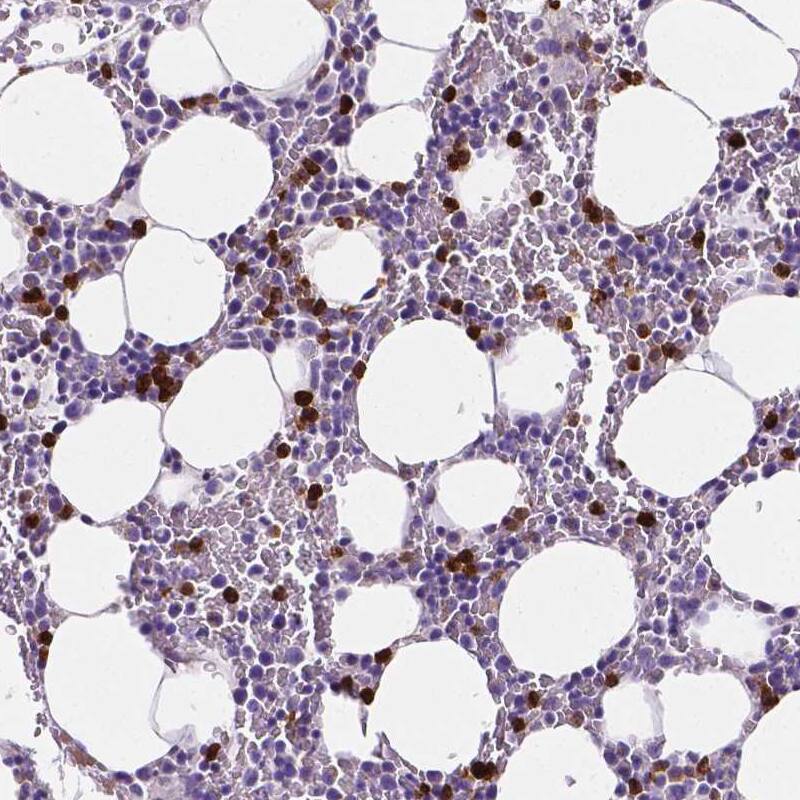 MMP-9 Antibody (CL0539) - Azide and BSA Free Immunohistochemistry-Paraffin: MMP-9 Antibody [NBP3-44016]
