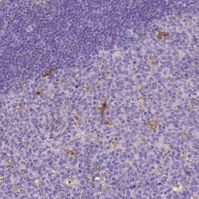 MMP-9 Antibody (CL0539) - Azide and BSA Free Immunohistochemistry-Paraffin: MMP-9 Antibody [NBP3-44016]