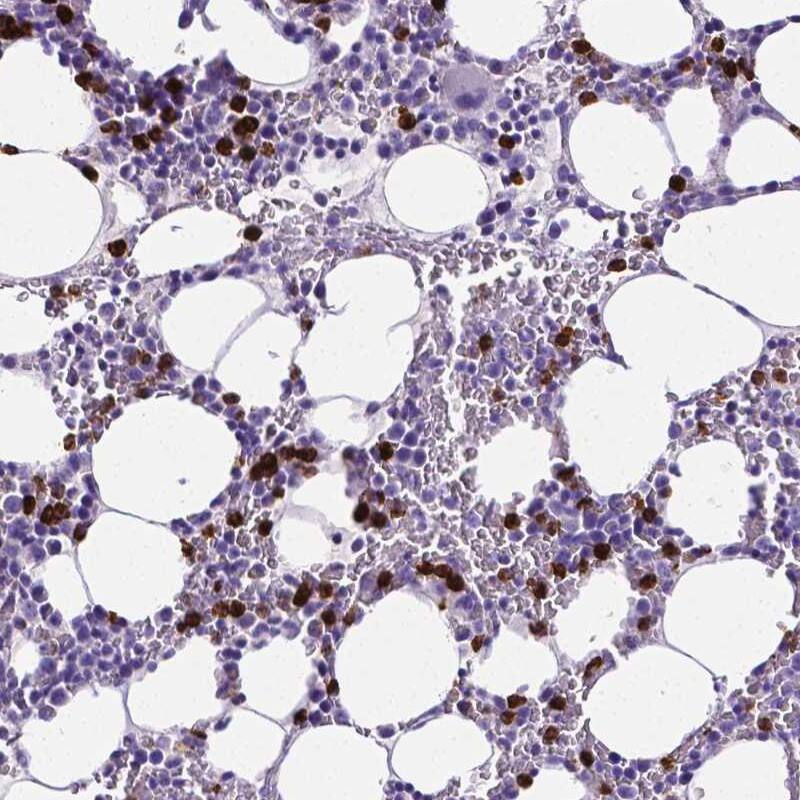 MMP-9 Antibody (CL0542) - Azide and BSA Free Immunohistochemistry-Paraffin: MMP-9 Antibody [NBP3-44017]