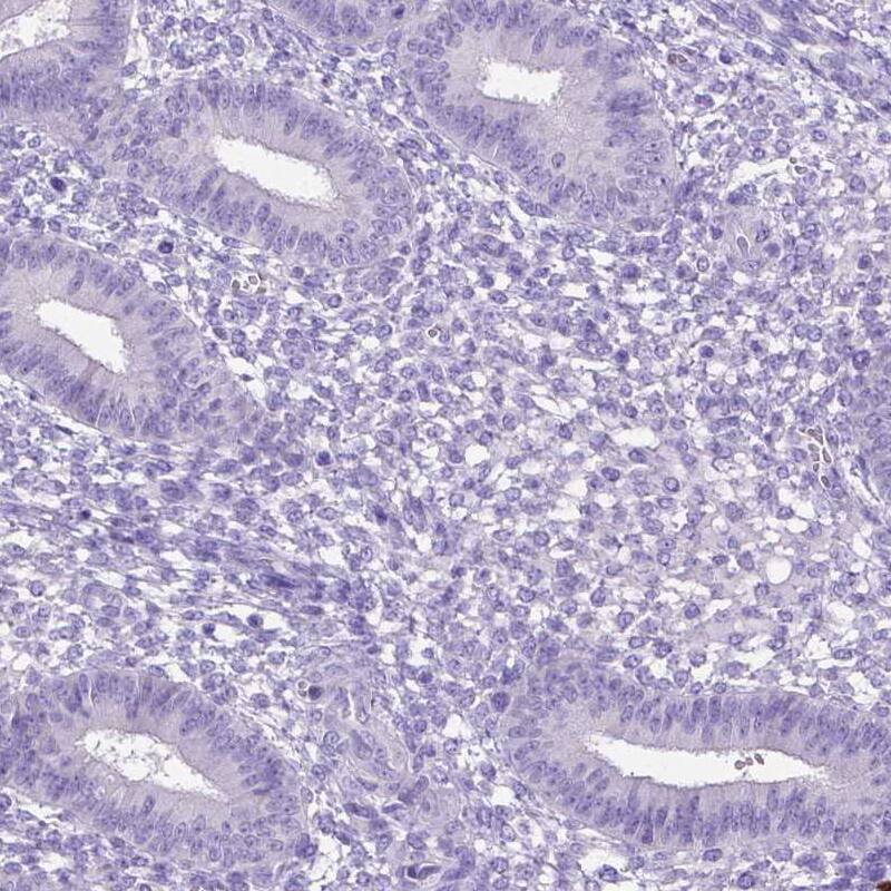MMP-9 Antibody (CL0542) - Azide and BSA Free Immunohistochemistry-Paraffin: MMP-9 Antibody [NBP3-44017]