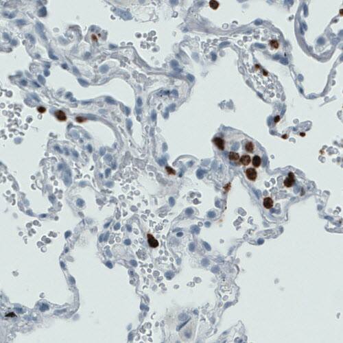 MMP-9 Antibody (CL0542) - Azide and BSA Free Immunohistochemistry-Paraffin: MMP-9 Antibody [NBP3-44017]