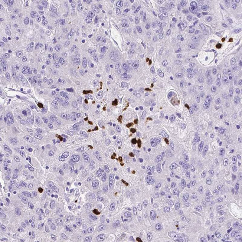 MMP-9 Antibody (CL0542) - Azide and BSA Free Immunohistochemistry-Paraffin: MMP-9 Antibody [NBP3-44017]