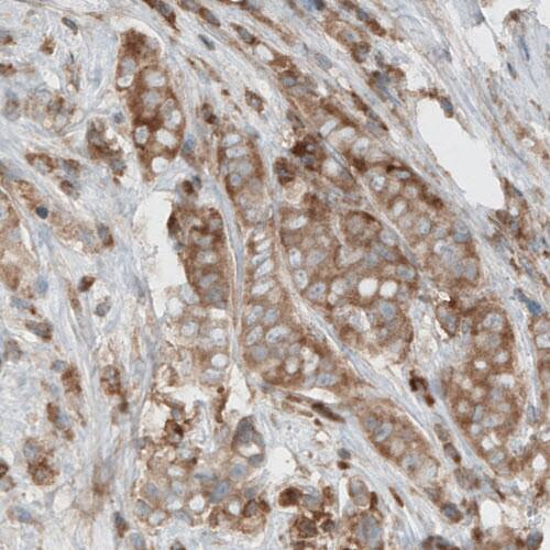 Dicer Antibody (CL0378) - Azide and BSA Free Immunohistochemistry-Paraffin: Dicer Antibody [NBP3-44018]