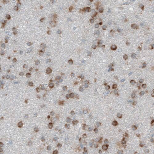 Dicer Antibody (CL0378) - Azide and BSA Free Immunohistochemistry-Paraffin: Dicer Antibody [NBP3-44018]