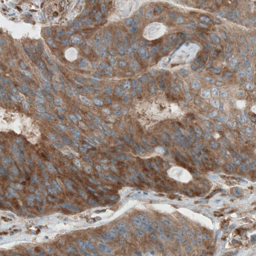 Dicer Antibody (CL0378) - Azide and BSA Free Immunohistochemistry-Paraffin: Dicer Antibody [NBP3-44018]
