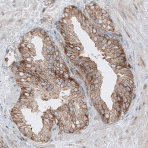 Dicer Antibody (CL0378) - Azide and BSA Free Immunohistochemistry-Paraffin: Dicer Antibody [NBP3-44018]