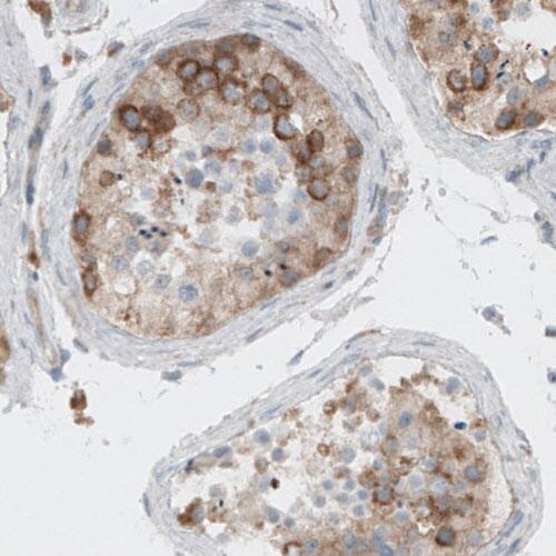 Dicer Antibody (CL0378) - Azide and BSA Free Immunohistochemistry-Paraffin: Dicer Antibody [NBP3-44018]