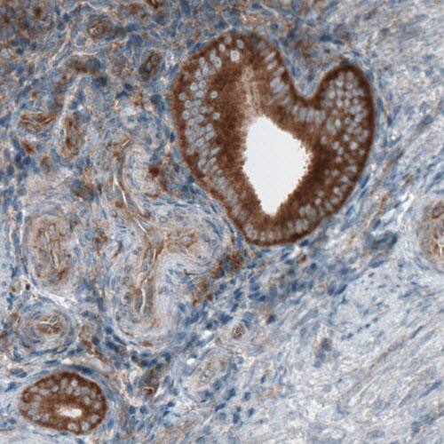 Dicer Antibody (CL0378) - Azide and BSA Free Immunohistochemistry-Paraffin: Dicer Antibody [NBP3-44018]